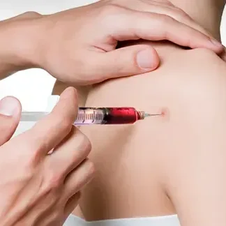TMI Sports Medicine PRP