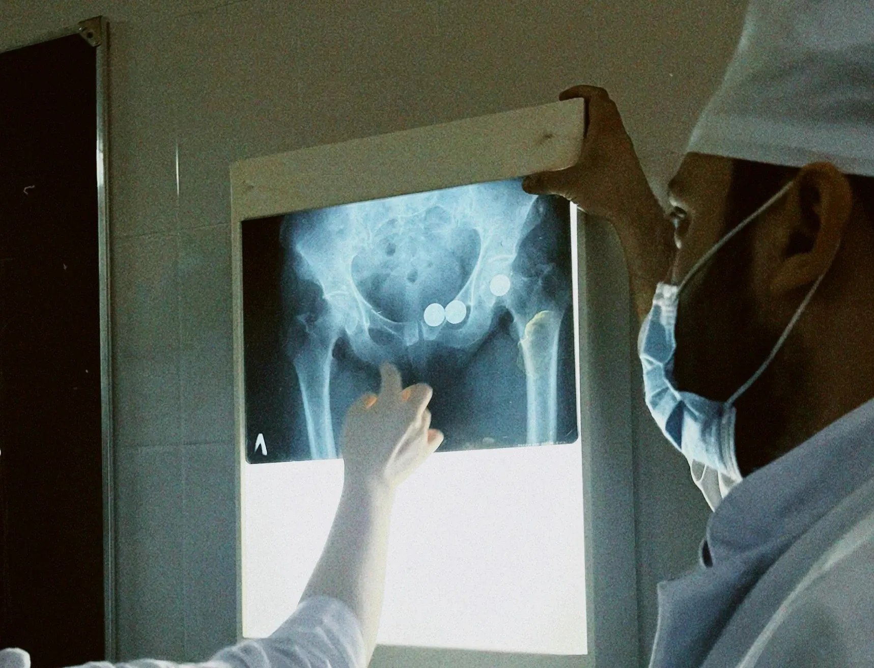 group of orthopedic doctors performing surgery