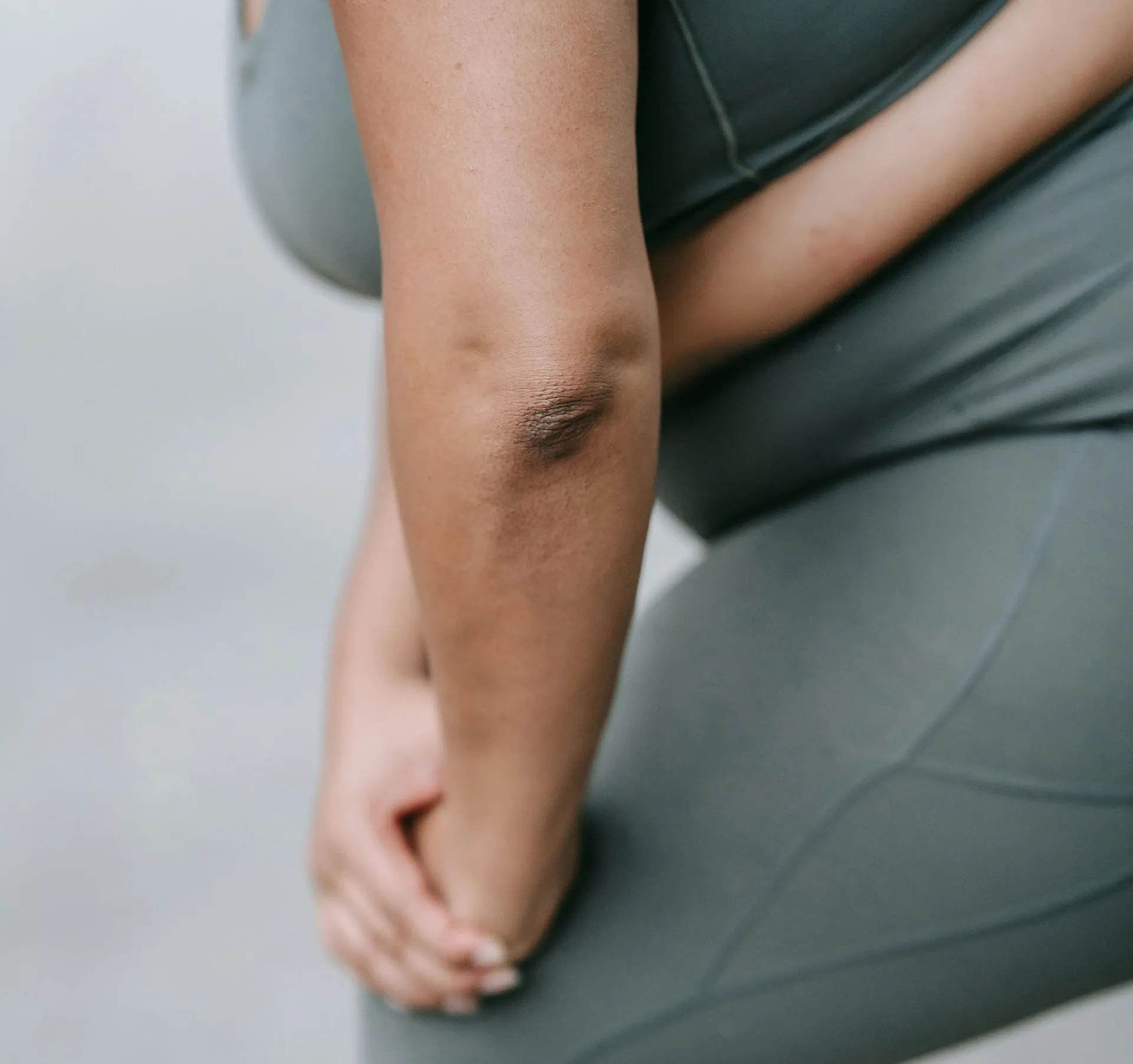 up close of woman's elbow